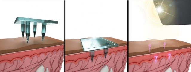 582e36a4f0674a2ed746acc593c199e8-8370865