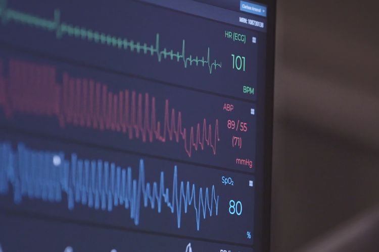 da1ff8df3f28136c6fecf04a6650631f-9098083