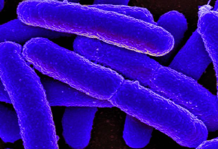 a4cdfd37a8a113a39012377c158f8eff-8471212